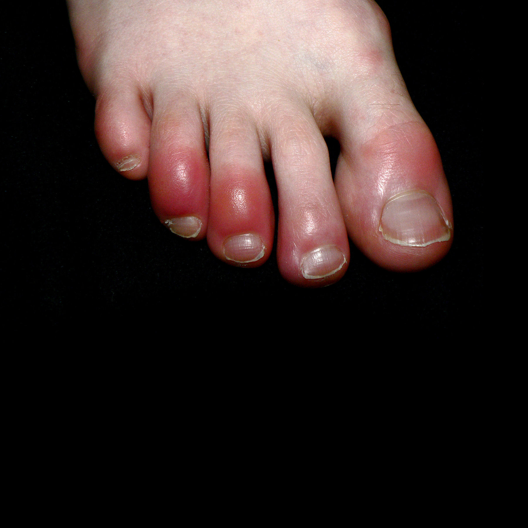 covid-toes.jpg covid-toes.jpg