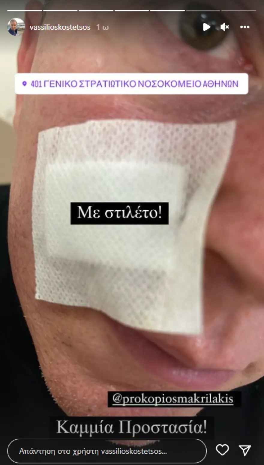 epithesi_kostetsos_6.jpg epithesi_kostetsos_6.jpg