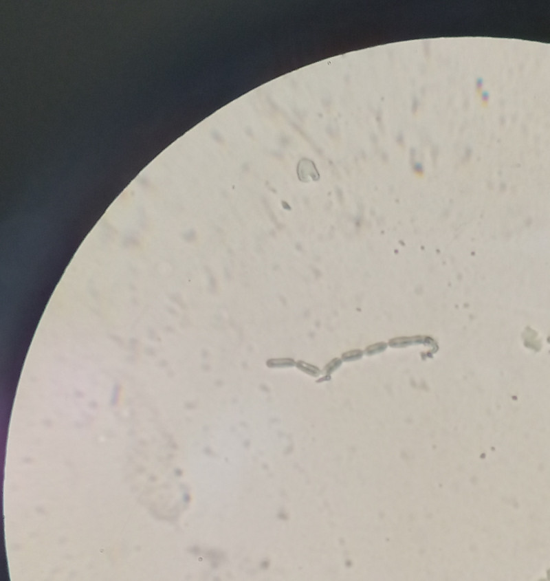 bacterium_microscopy.jpg bacterium_microscopy.jpg