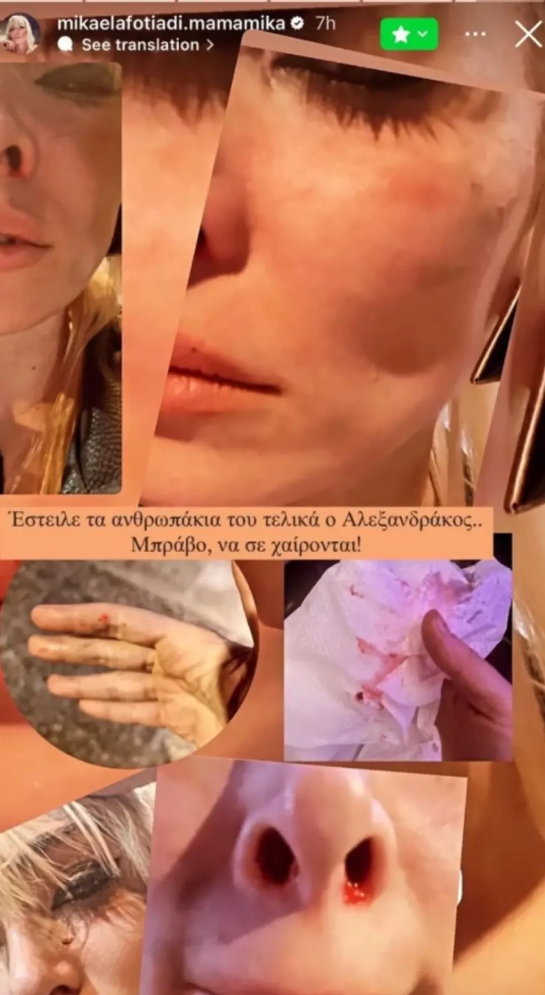 fotiadi_xylo_1jpg.jpg fotiadi_xylo_1jpg.jpg