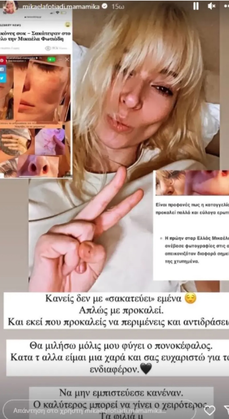 fotiadi_xylo_2.jpg fotiadi_xylo_2.jpg