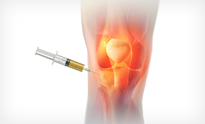 featured_study-shows-prp-is-more-effective-than-hyaluronic-acid-for-knee-arthritis_1.jpg