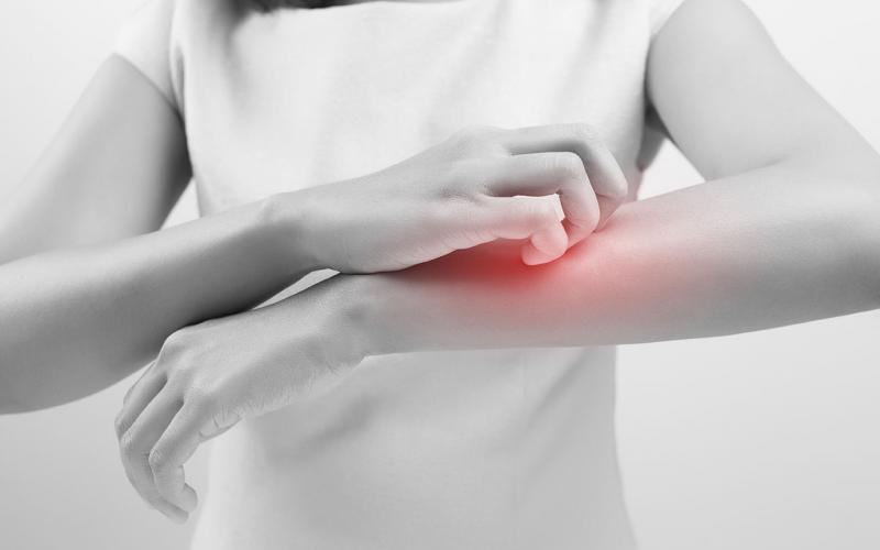 psoriasiki-arthritida