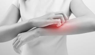 psoriasiki-arthritida