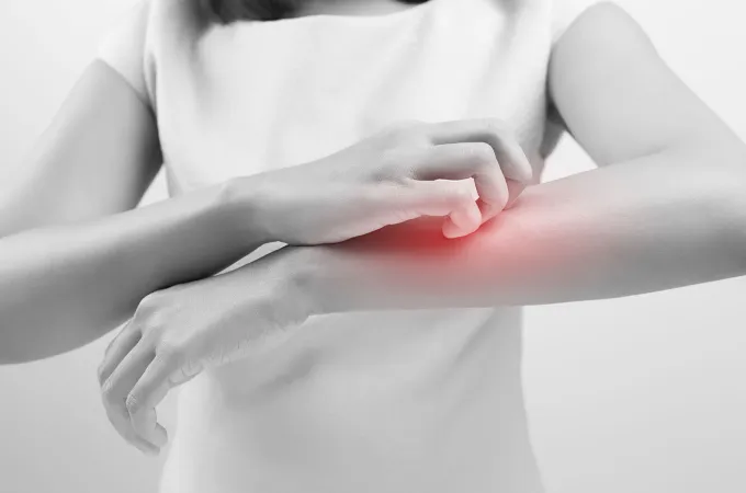 psoriasiki-arthritida